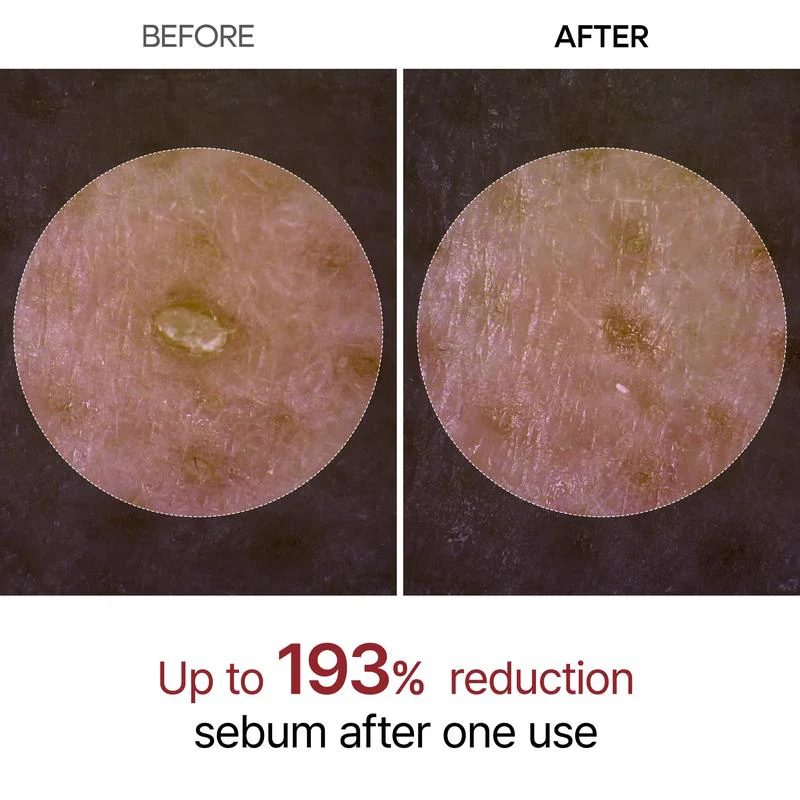 Peel Shot Glow Rice Ampoule Duo - Image 6