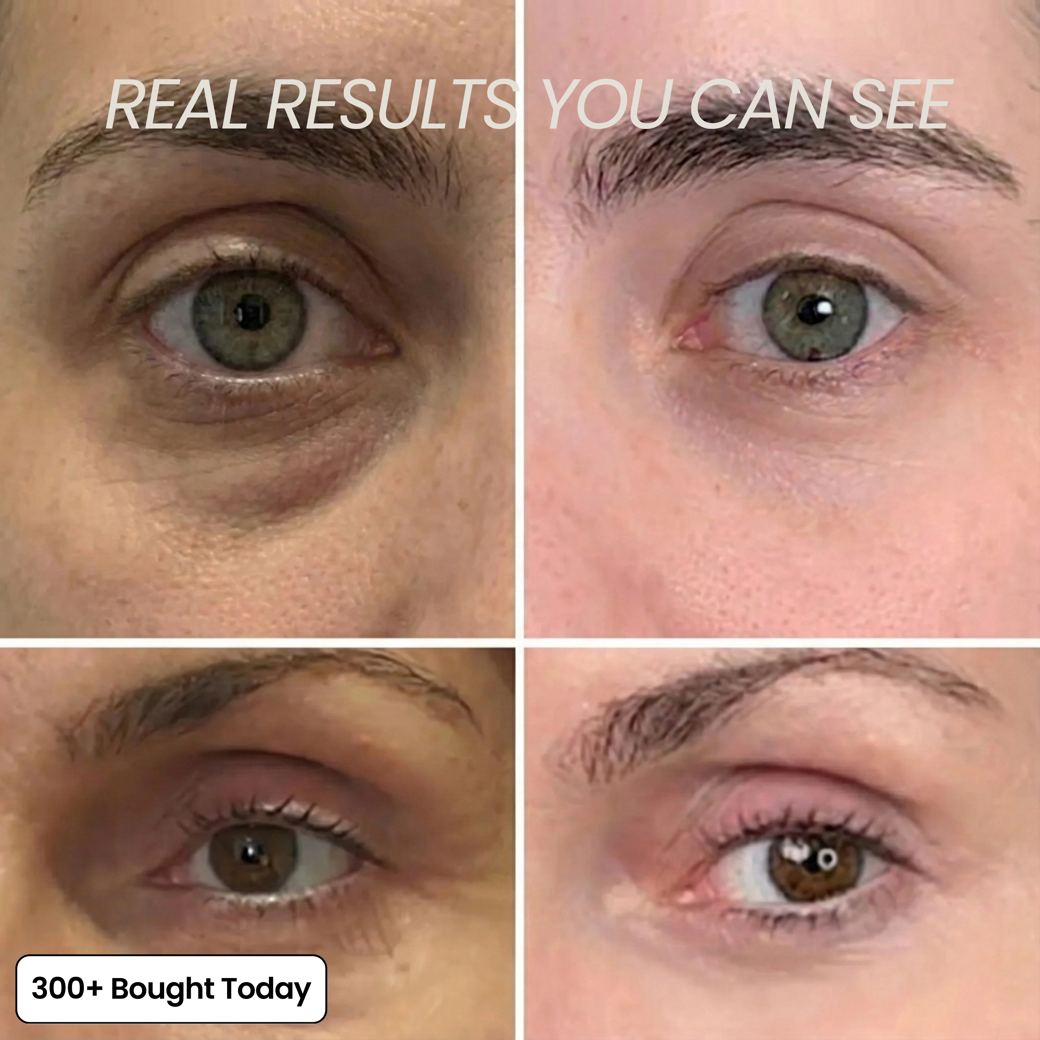 Transform Wrinkles, Fine Lines, And Tired Creases Naturally - Image 6