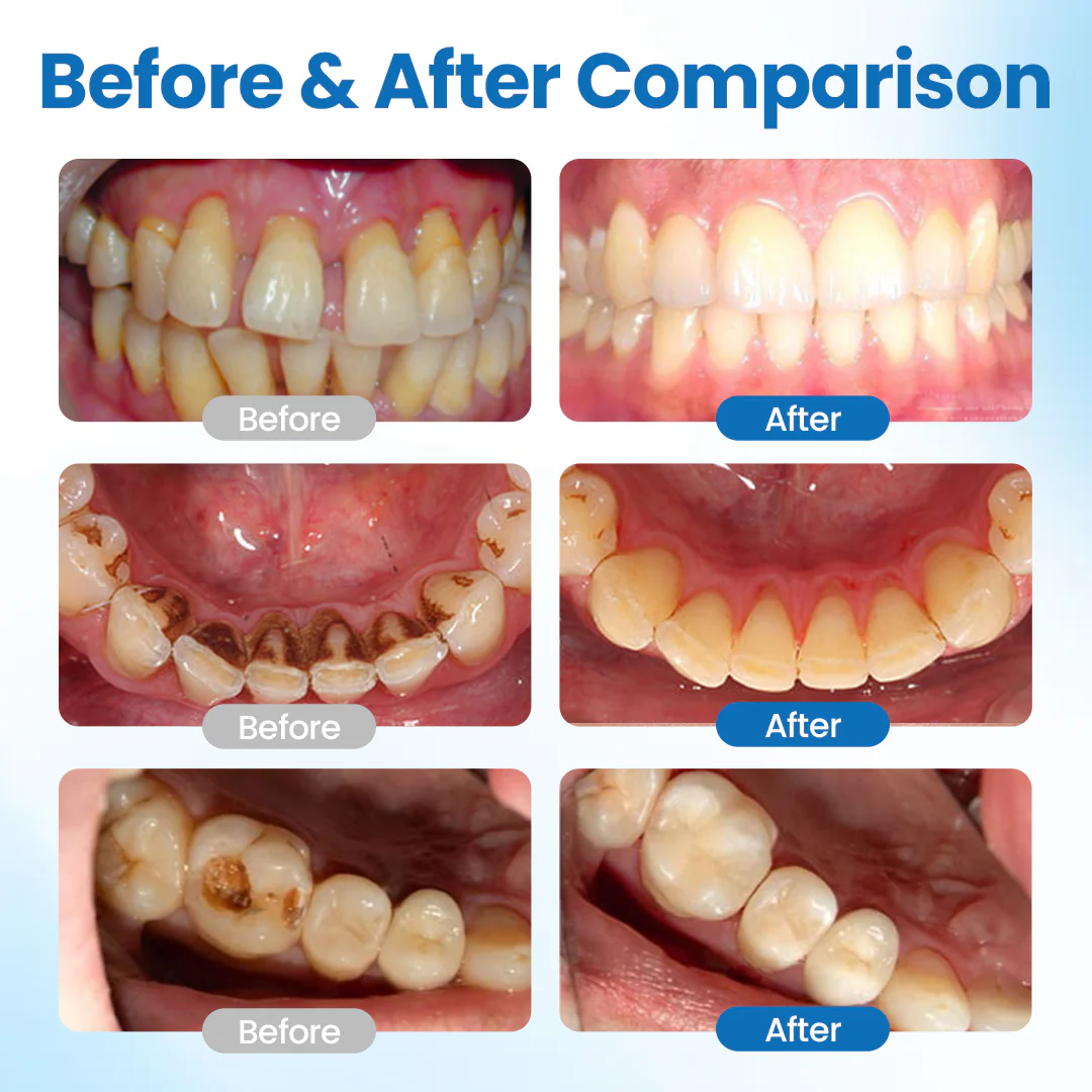 Tiktrove⢠NanoHAP Tooth Defense Serum - Image 4