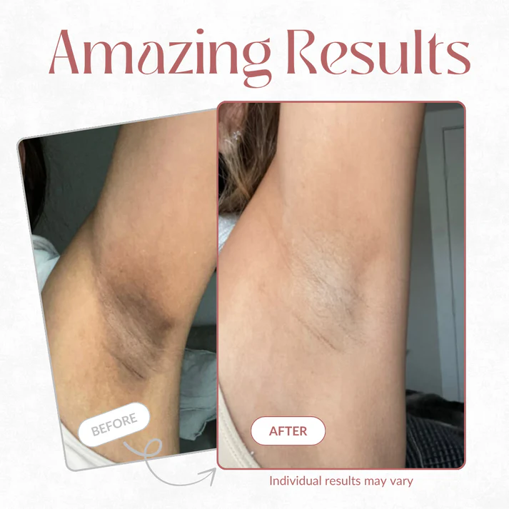 Tiktrove Peel Shot - Kojic + Turmeric Body Peel Spray - Image 4