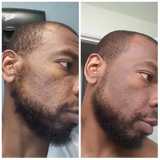 Radiant Blowout Routine Set | Dark Spot & Peeling Care - Image 3