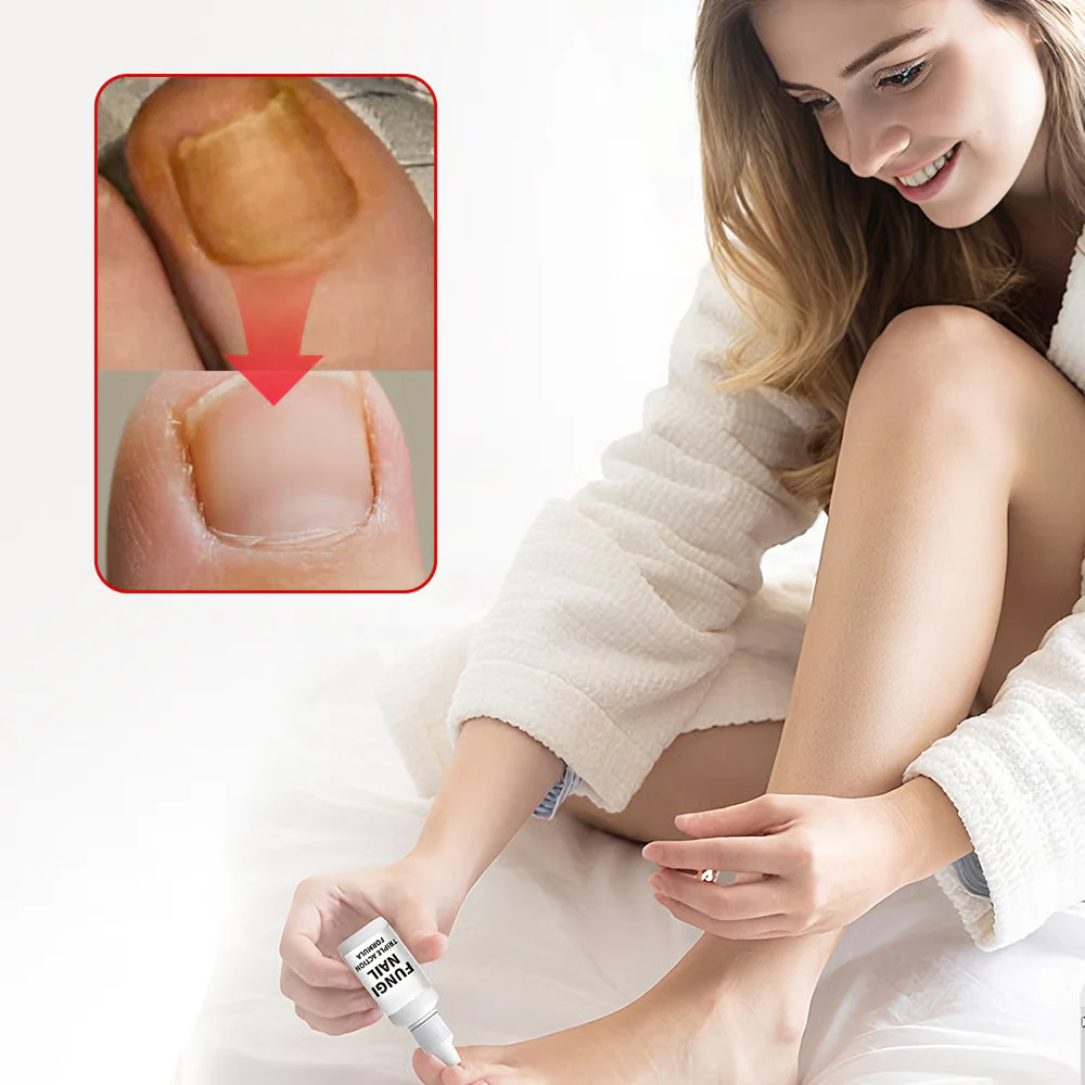 Toenail Fungus Treatment Extra Strength - Image 4